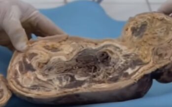 ŠOKEERIV! Naine põgeneb rasedana haiglast ja naaseb alles 46 aastat hiljem – arstidele avaneb täiesti uskumatu vaatepilt! + Dokumentaal VIDEO!