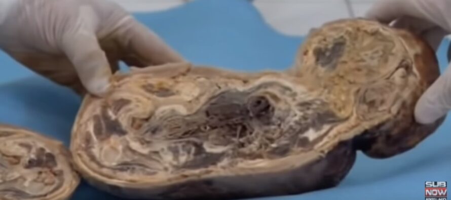 ŠOKEERIV! Naine põgeneb rasedana haiglast ja naaseb alles 46 aastat hiljem – arstidele avaneb täiesti uskumatu vaatepilt! + Dokumentaal VIDEO!